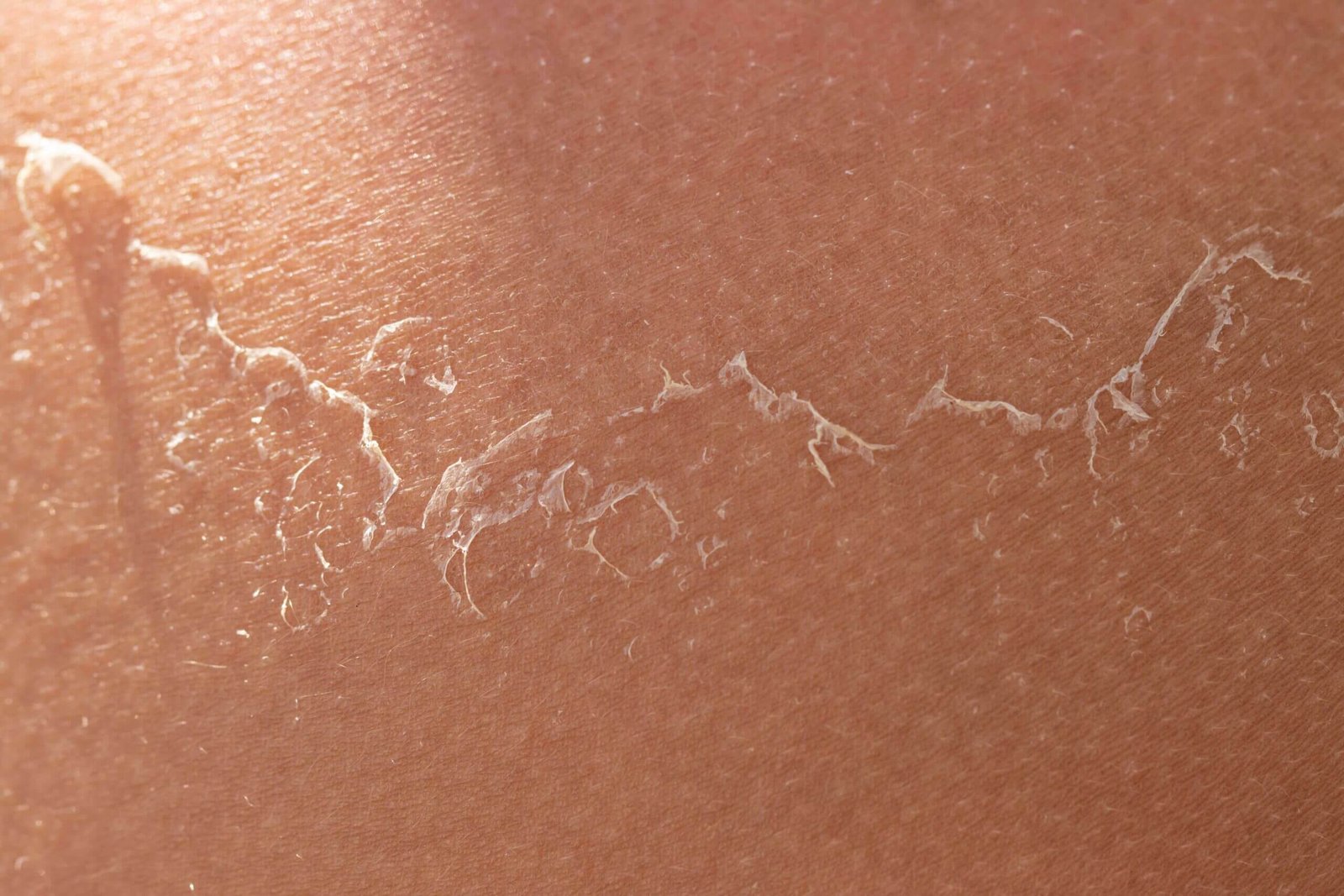 Shrushti-skin-clinic